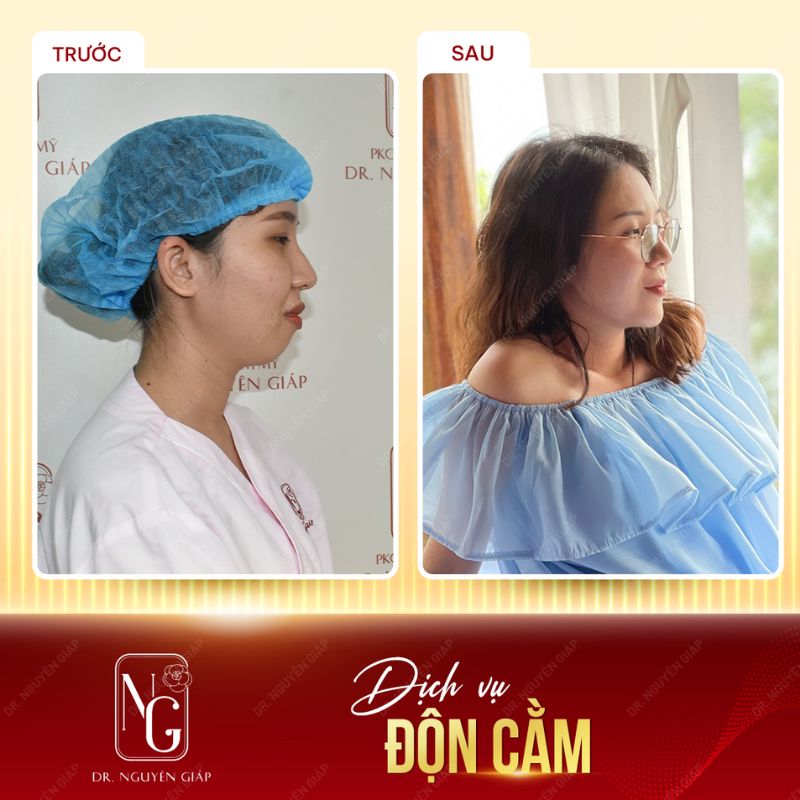 Câu chuyện khách hàng chia sẻ
