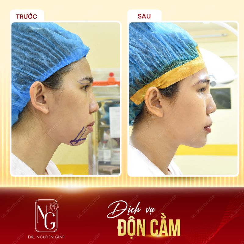 Câu chuyện khách hàng chia sẻ