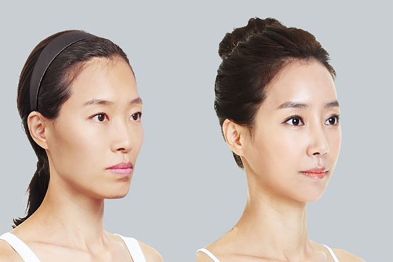 Lợi ích của dịch vụ