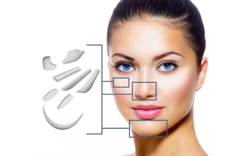 Nâng mũi cấu trúc sụn Surgiform xu hướng dẫn đầu năm 2021