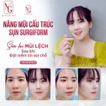 Trả lời nạn nhân thẩm mỹ: khi hy vọng vẫn còn