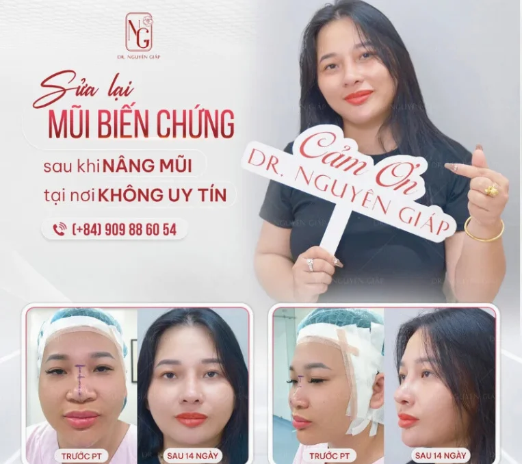 sua lai bien chung nang mui