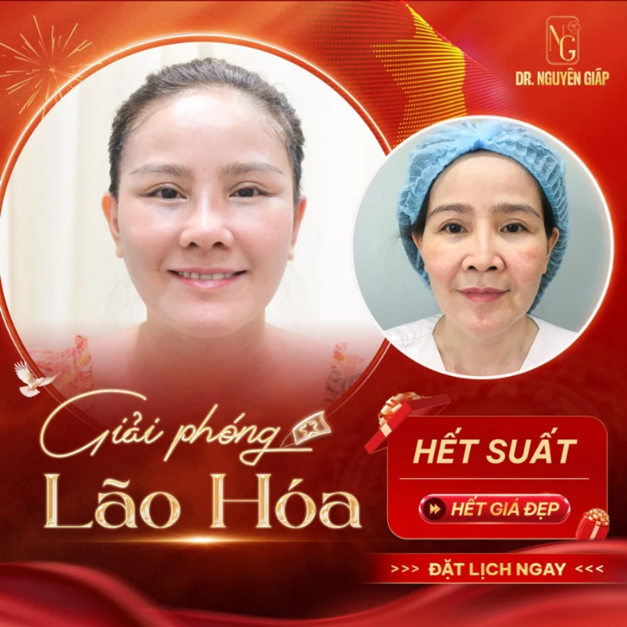 cang da mat nhan dip 30 thang 4 Căng da mặt nhân dịp 30 tháng 4